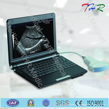 Volldigitaler Ultraschallscanner für Laptops (THR-LT003)